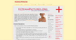 Desktop Screenshot of eczemapictures.org